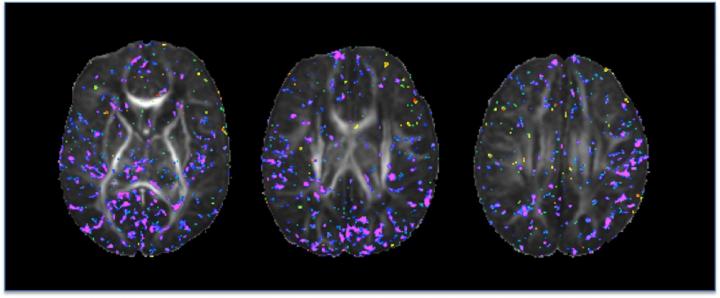 Newborn Brain Images