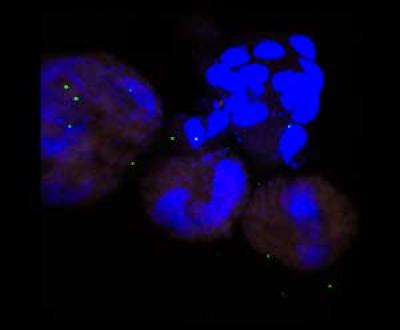 Lingulodinium polyedrum Cells