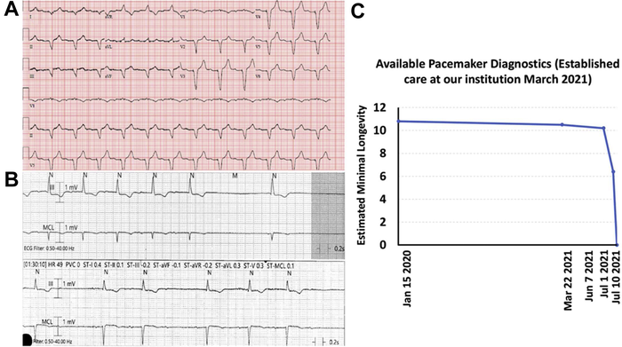 Remote monitoring doesn’t always detect catastrophic pacemaker failure
