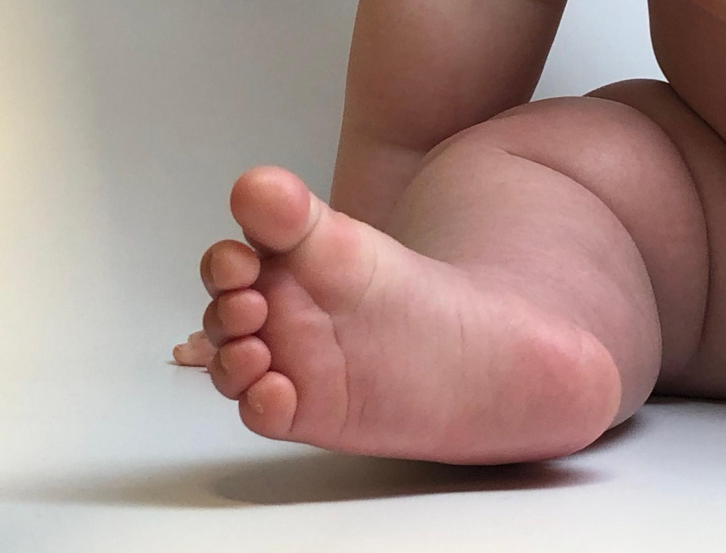 An infant's leg and foot.