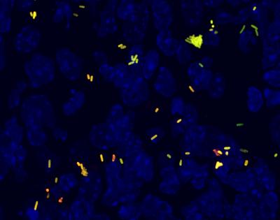 Antibiotic Treatments