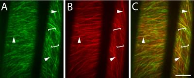 Cellulose Synthase and Tubulin