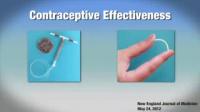 IUDs, Implants are Most Effective Birth Control