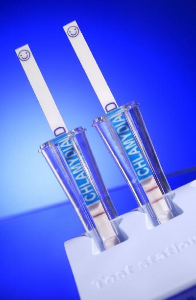 Chlamydia Rapid Test for Men