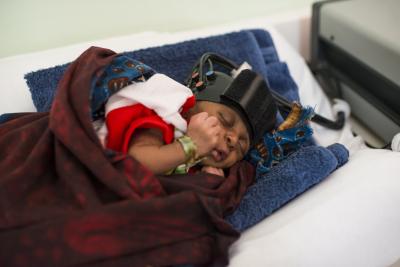 Baby Wearing the Functional near Infra-Red Spectroscopy Monitor