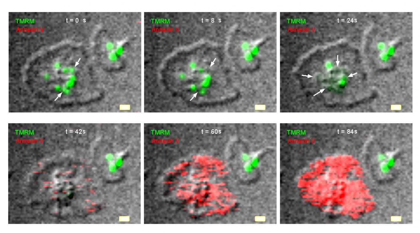 Figure 2: Mitochondrial Necrosis
