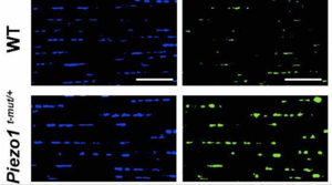 Gene variant gives mice super-powered tendons for jumping and running