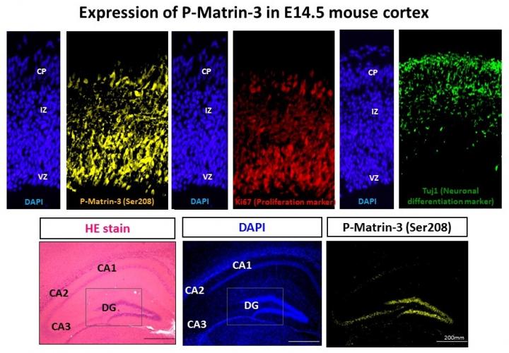 Expression of Phosphorylated Matrin-3 in the E14.5 Mouse Cortex