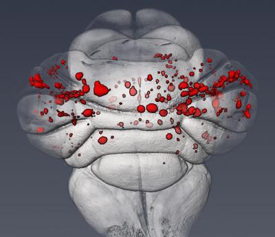 Cerebral Cavernous Malformations