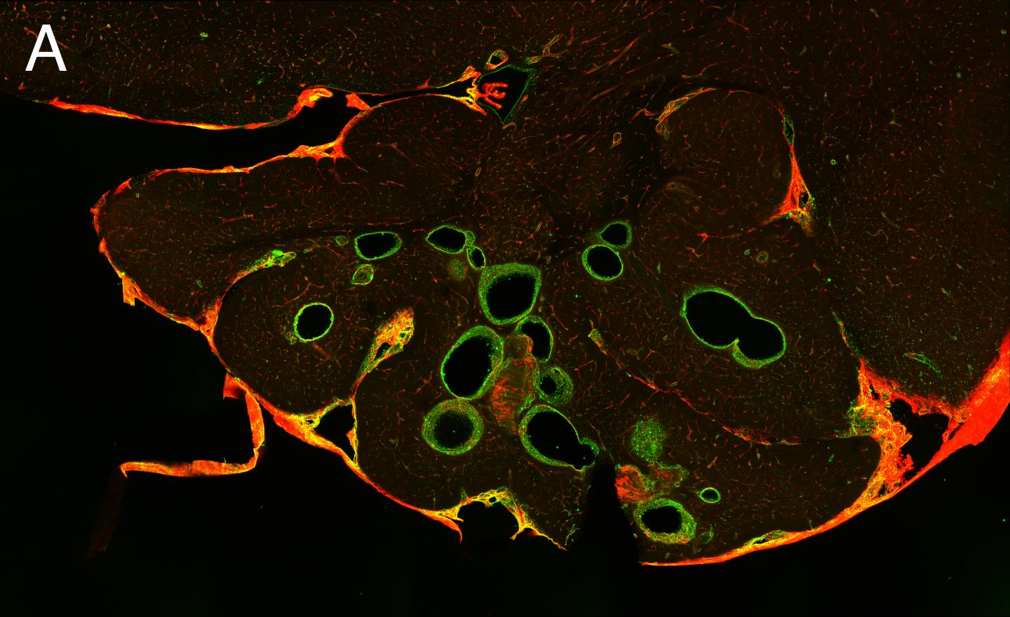 Brain section no propranolol