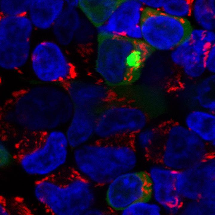 Control of Carbs, Fat and Protein Metabolism