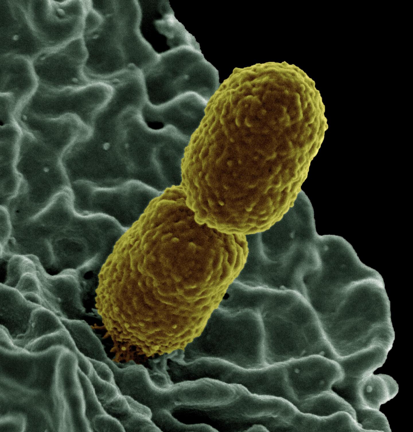 <i>Klebsiella</i>