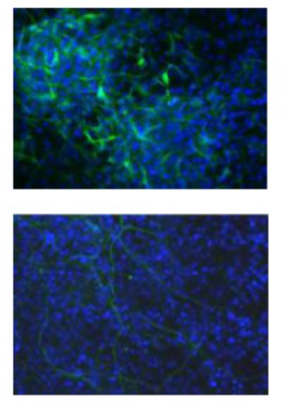 H1 Triple Knockout Neural Impairment
