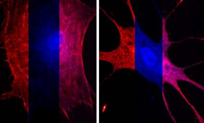 Stress-Shaped Proteins (2 of 3)