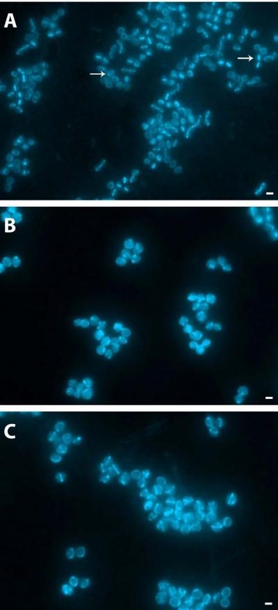 Outsmarting Drug-Resistant MRSA (1 of 2)