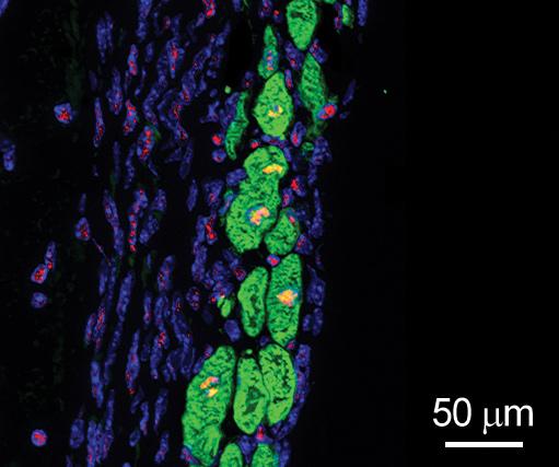 New Heart Muscle Cells