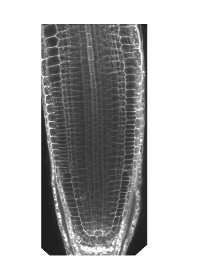 Plant Phloem Differentiation in a Root