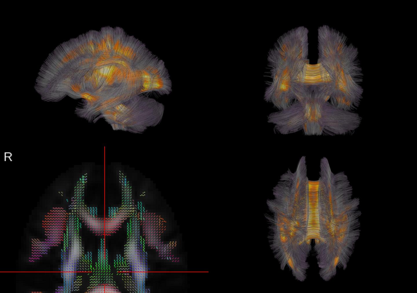 Brain Wiring Diagrams [IMAGE] | EurekAlert! Science News Releases