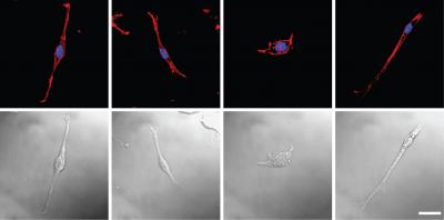 Scorpion Venom (2 of 2)