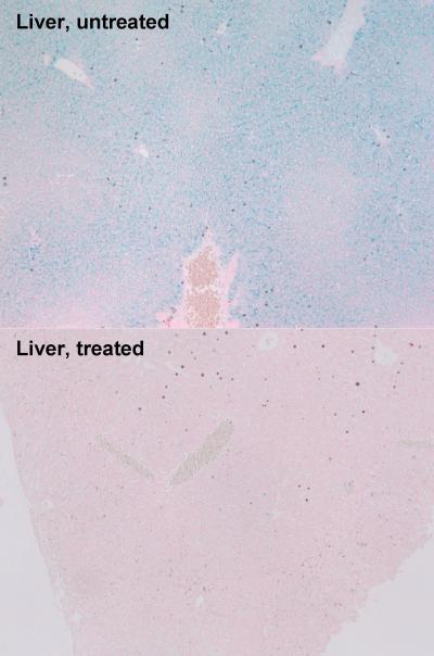 Minihepcidin Treatment