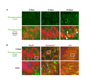 Fig.1　 Seed-dependent accumulation of phosphorylated alpha-synuclein in the brain of wild-type mice.