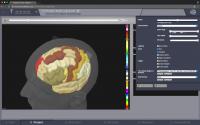 Using The Virtual Brain Software