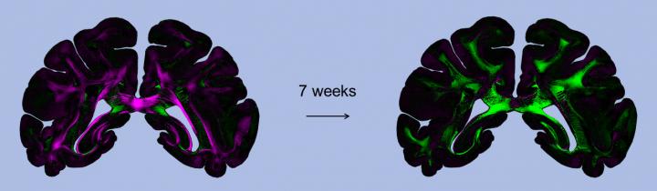 Diattenuation Imaging  (DI) Reveals Regional Differences