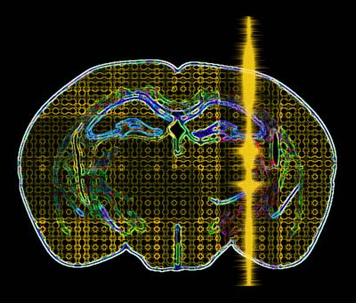Artistic Rendition of an Ultrasound Pulse