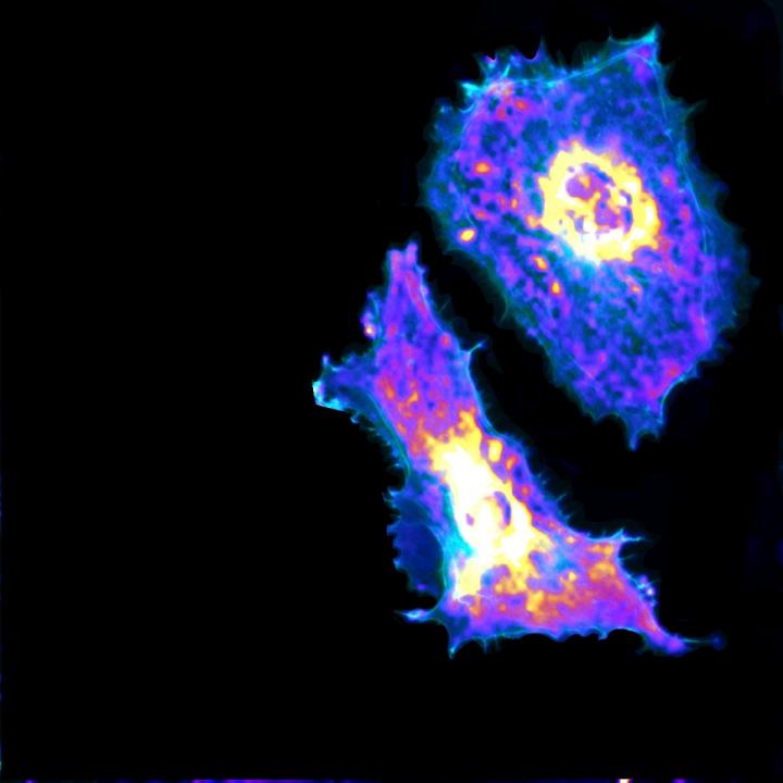 Watching a cell metabolize live