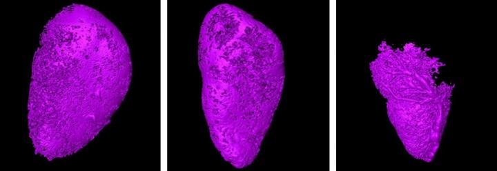 A Peek into Lymph Nodes (1 of 2)