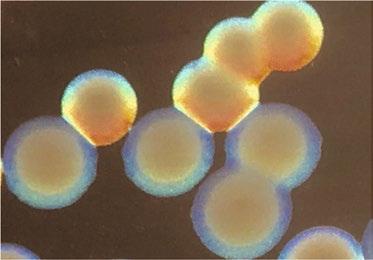 Colonies of <i>Acinetobacter baumannii</i> Forms