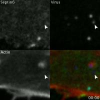 Vaccinia Virus Can Escape Protein Cage that Traps Them in the Cell