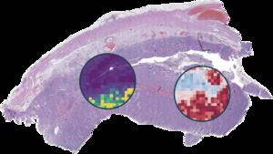 AI-based Image Analysis for Biomarker Prediction