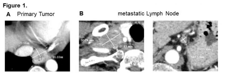 CT Evaluation