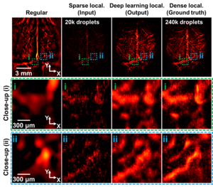 Deep Learning-Based 2D Labeled Localization Photoacoustic Computed Tomography.