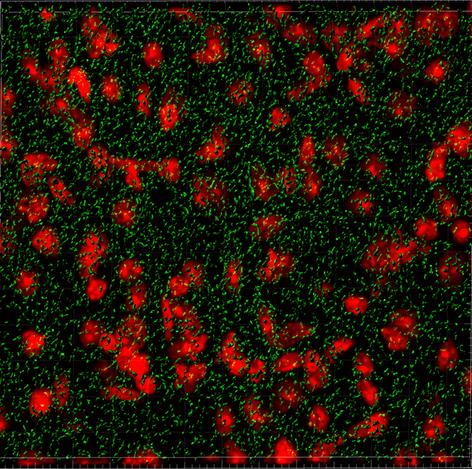 Stress granules in HD model