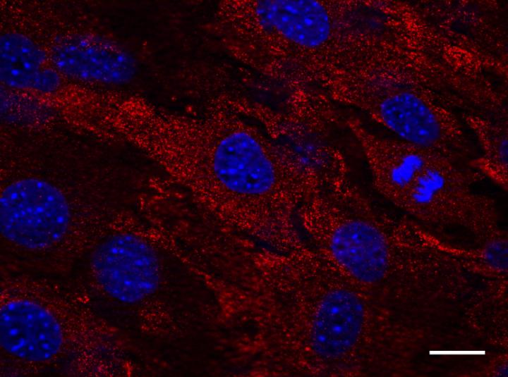 Cells from a Transgenic Mouse Expressing Human MxA