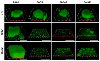 Inactivation of the Expression of 3 Key Regulators