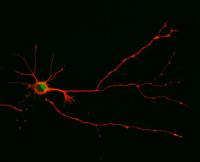 Excess Axons