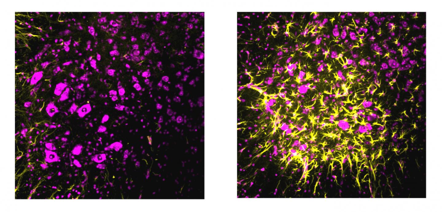 Synaptic Repair Mechanism Protects Against Neurodegeneration