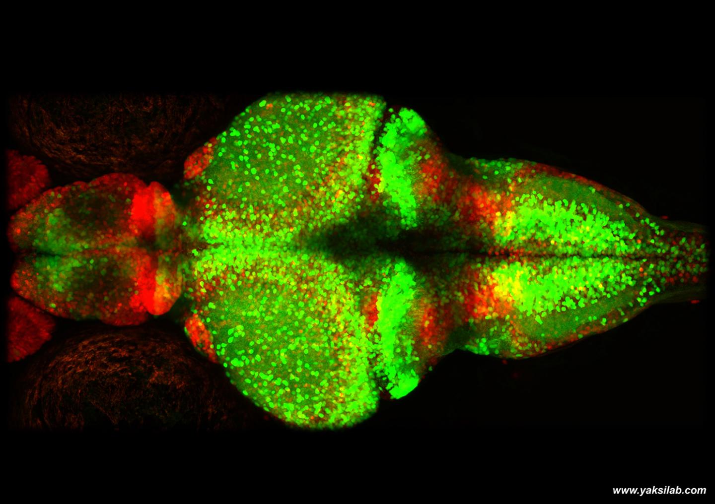 Young Zebrafish Brain