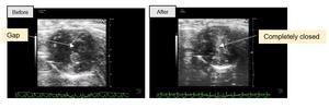 (L-R): Echocardiograms of the bat’s heart, showing before and after dobutamine administration respectively.