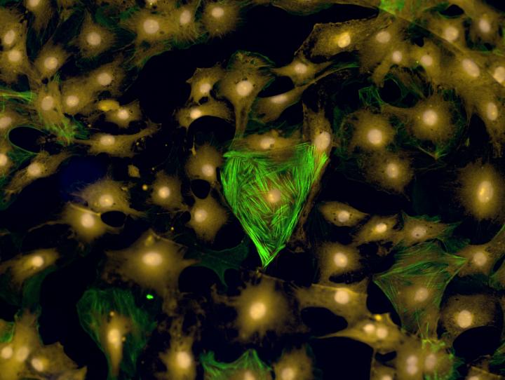 Cardiac Cells on a Hydrogel