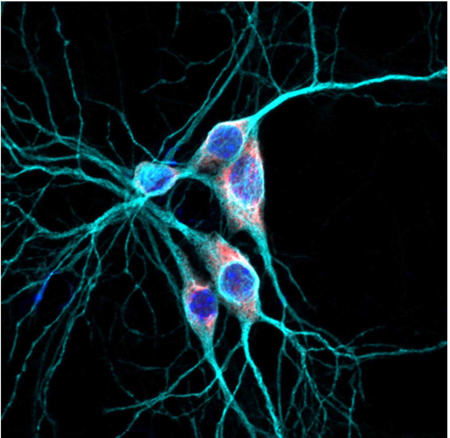 Rbfox1 in the Cell's Cytoplasm