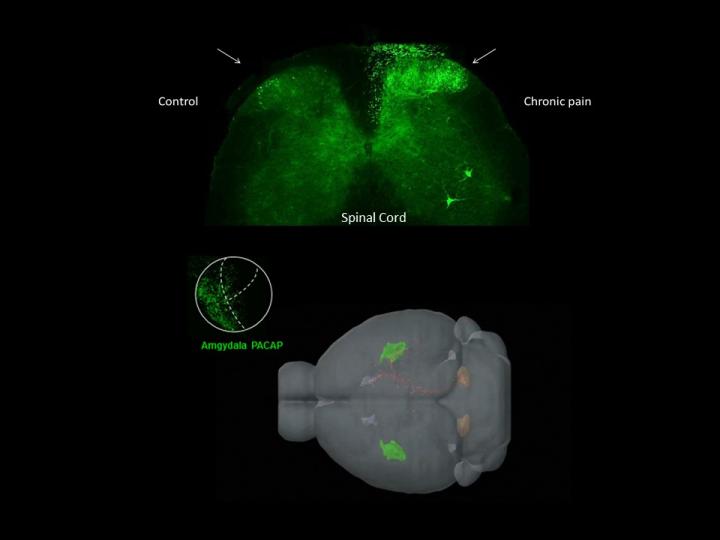 PACAP Neurotransmitter Signal Travels from Spinal Cord to Amygdala