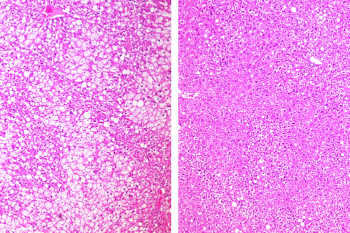 Drug mimics beneficial effects of fasting in mice