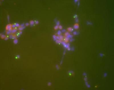 Macrophages -- Treated With Nonregulatory T Cells