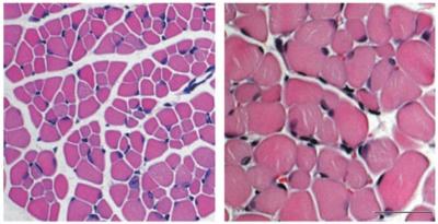 SMA Mice Muscle +/- Fasudil