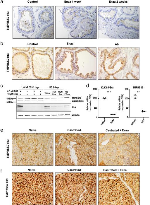 TMPRSS2 protein expression in the prostate and prostate cancer is not primarily driven by androgen