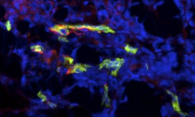 {Delta}-Catenin Expressed in Vascular Endothelial Cells